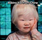 An albino kid from China…