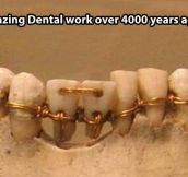 Vintage dental work…