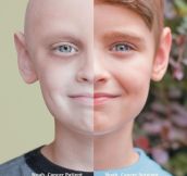 Then and now: Cancer patient vs survivor