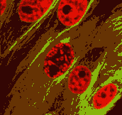Epithelial Cell Undergoing Mitosis