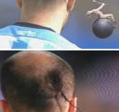 OF ALL THE HAIRSTYLES IN THE WORLD…
