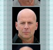 Evolution Of A Bald Man