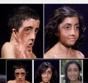 Zubaida Hasan’s Amazing Face Reconstruction