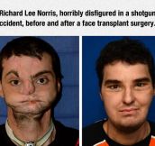 This Surgeon Did A Fantastic Job