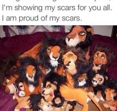 Showing My Scars