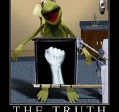 Kermit’s x-ray…