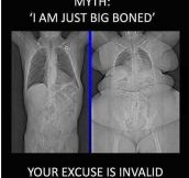I’m just big boned…