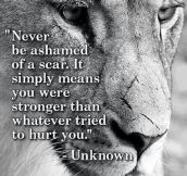 Never be ashamed of a scar…