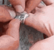 How To Remove A Stuck Ring