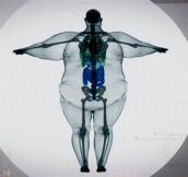 X-Ray Of A 900 Pound Man