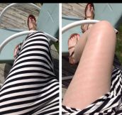 Striped Legs