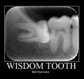 The Unexpected Wisdom Tooth