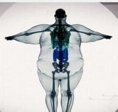 There Is No Such Thing As Big Boned