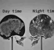 My Brain Every Night