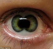 15 Totally Freaky Contact Lenses!!