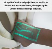 Clever Medical Invention: The VeinViewer