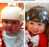 Baby Medical Helmets