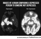 When A Brain Is Depressed