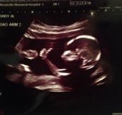 Baby Approves Ultrasound