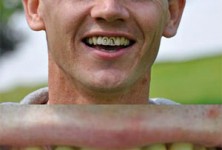 teeth-tatoo