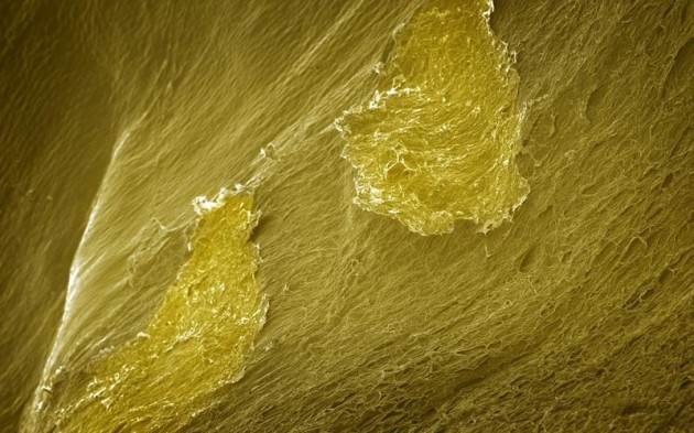 Food Electron Microscope 08 630x393 Amazing Photographs of Food Taken With Electron Microscope