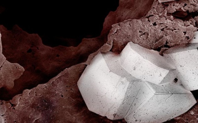 Food Electron Microscope 09 630x393 Amazing Photographs of Food Taken With Electron Microscope
