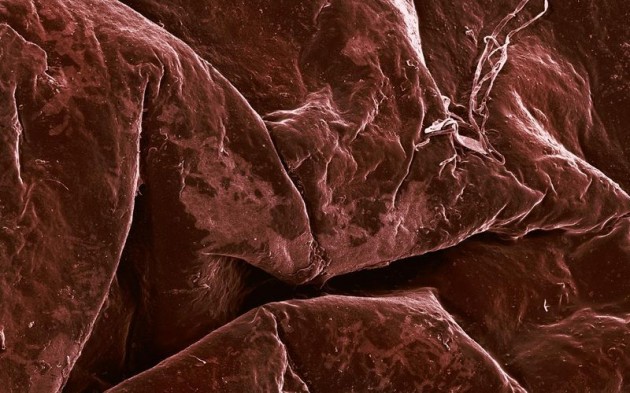 Food Electron Microscope 10 630x393 Amazing Photographs of Food Taken With Electron Microscope