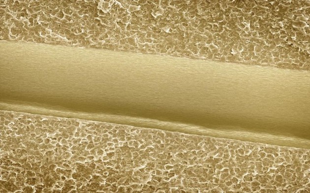 Food Electron Microscope 12 630x393 Amazing Photographs of Food Taken With Electron Microscope