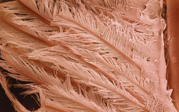 Food Electron Microscope 13 630x393 Amazing Photographs of Food Taken With Electron Microscope