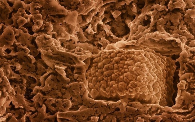 Food Electron Microscope 14 630x393 Amazing Photographs of Food Taken With Electron Microscope