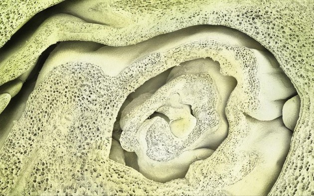 Food Electron Microscope 16 630x393 Amazing Photographs of Food Taken With Electron Microscope