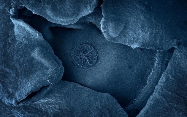 Food Electron Microscope 19 630x393 Amazing Photographs of Food Taken With Electron Microscope