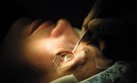 wrong eye 10 Most Horrible Medical Mistakes Made by Doctors