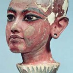 cranial-deformation2
