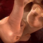 elephant-womb-thesuiteworld