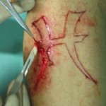 scarification2