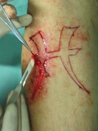 scarification2 The 10 Most Weird Body Deformation Practices
