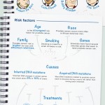 prostate-Cancer
