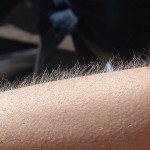 Getting goosebumps from music