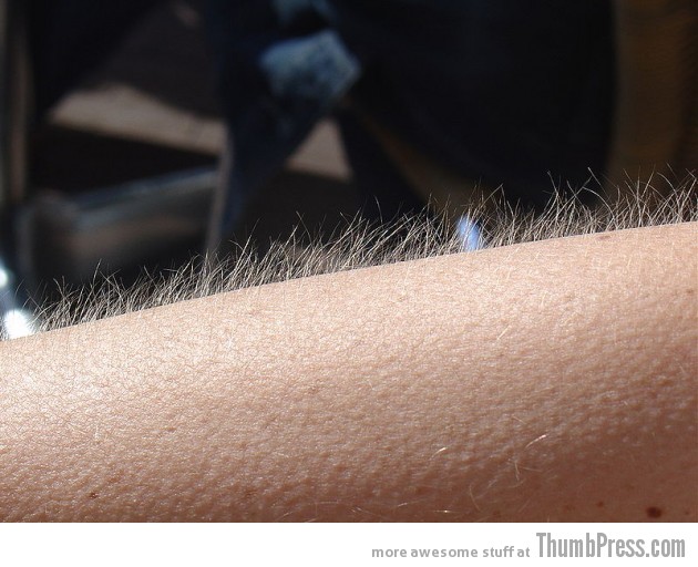Getting goosebumps from music