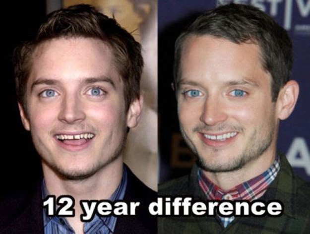 Celebs Who Doesn’t Seem To Be Getting Older — Elijah Wood