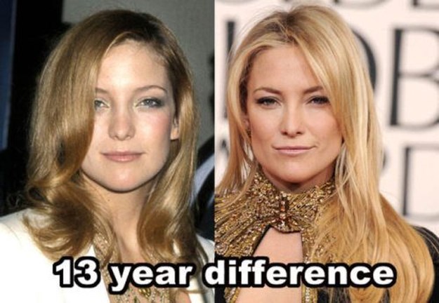Celebs Who Doesn’t Seem To Be Getting Older — Kate Hudson