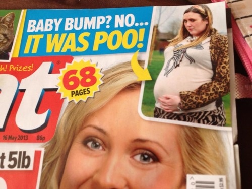 WTF of the day — Must have been a weird childbirth…