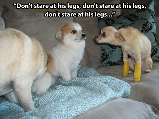 Don’t stare at his legs…
