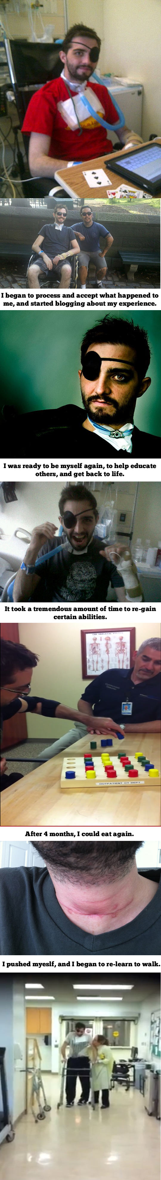 funny-survived-brain-injury-guy