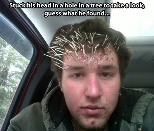 funny-guy-face-porcupine-spines