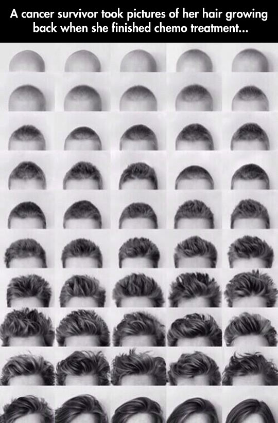 cool-Cancer-survivor-patient-photographs-hair-growth