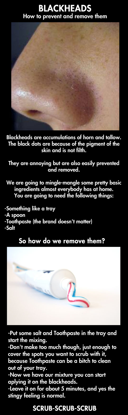 How To Get Rid Of Those Annoying Blackheads