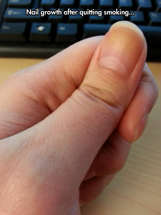funny-nail-smoking-yellow-growing