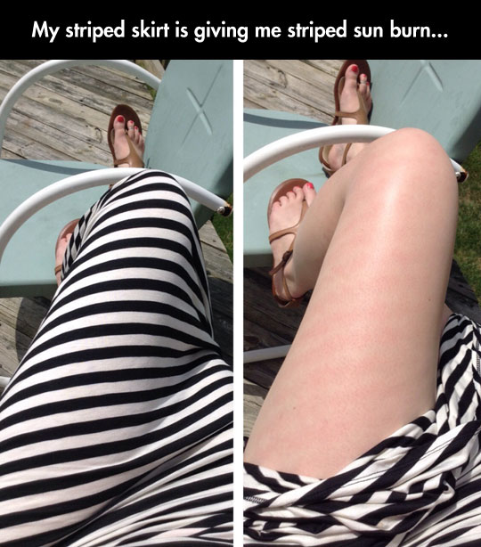 Striped Legs